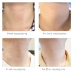 AROCELL Super Neck Intensyvaus Poveikio Kaklo Kremas 80 g - Image 3